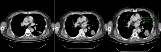 靜脈期.png 靜脈期.png